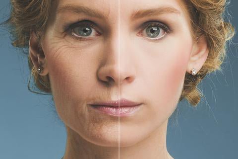Using AngelLift and Dermasome Together