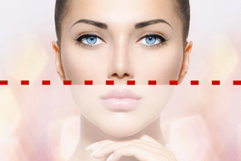 The Botox No-Fly Zone