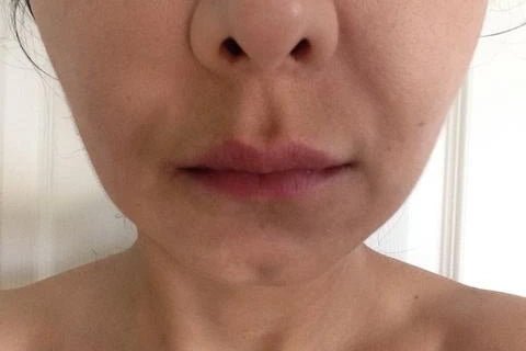 Christina’s AngelLift Journey Week Five