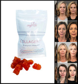Protynal® Collagen Supplements