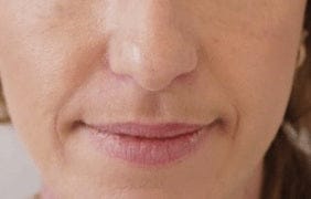 Sonia, 55, day 1