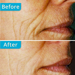 AngelLift® Collagen DermaStrips