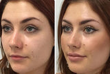 AngelLift® Member Care - Vermillion DermaStrips